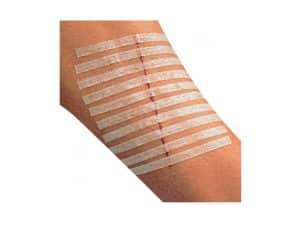 PharmaStrip,-Bandes-pour-sutures-cutanées3