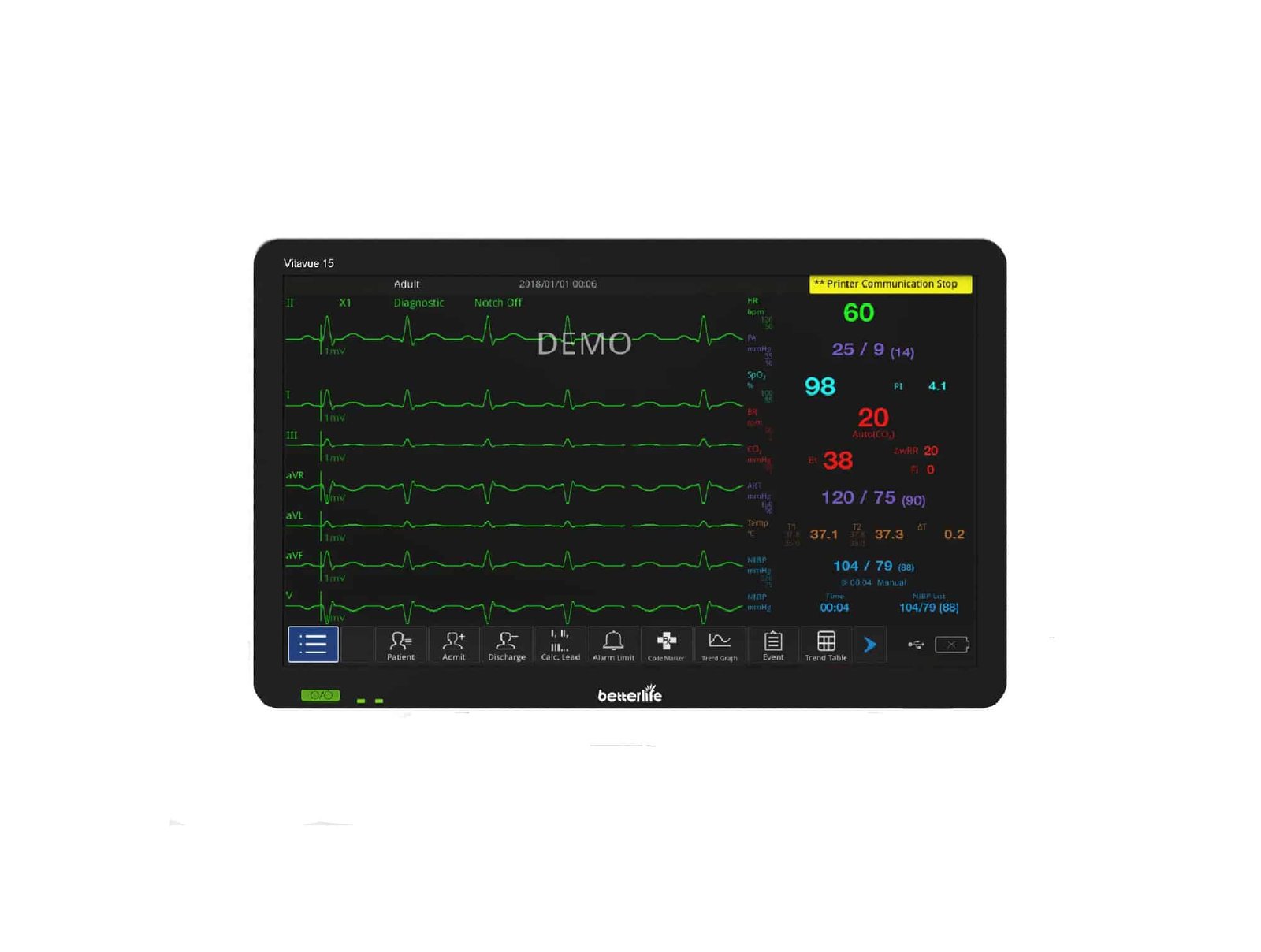 Moniteur patient ECG VITAVUE 15 1