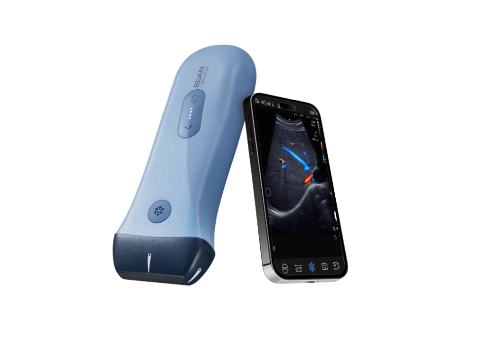 echographe portable nano C12 (1)