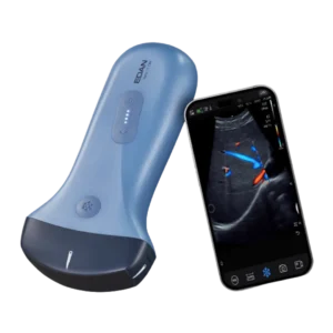 echographe ultra portable